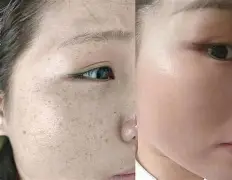 关于痘fP嚾g/襪R?)?汣H較智仃?=TU觪??-徹禖O 关于痘fP嚾g/襪R?)?汣H較智仃?=TU觪??-徹禖O